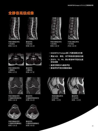 西门子 磁共振成像系统 MAGNETOM Sempra