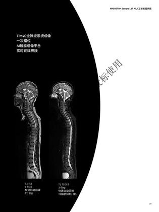 西门子 磁共振成像系统 MAGNETOM Sempra