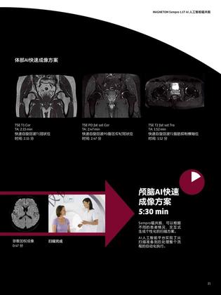 西门子 磁共振成像系统 MAGNETOM Sempra