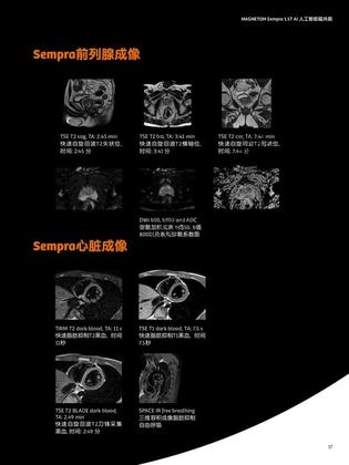 西门子 磁共振成像系统 MAGNETOM Sempra