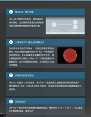 励视 眼科Nd:YAG激光治疗仪 Ultra Q
