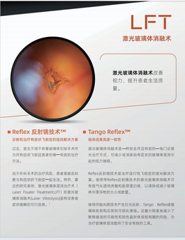 眼科Nd:YAG激光治疗仪 Tango Reflex