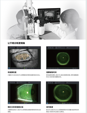 上海美沃 裂隙灯显微镜 S390H