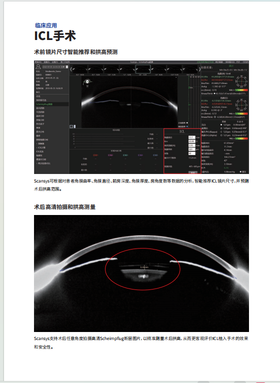 上海美沃 三维眼前节分析系统 Scansys TA517