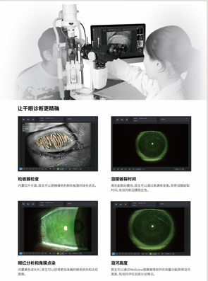 上海美沃 裂隙灯显微镜 S390L