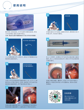 威朗 预装式张力环 ACPi-11