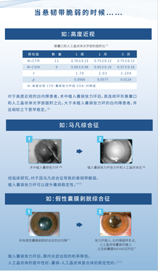威朗 预装式张力环 ACPi-11